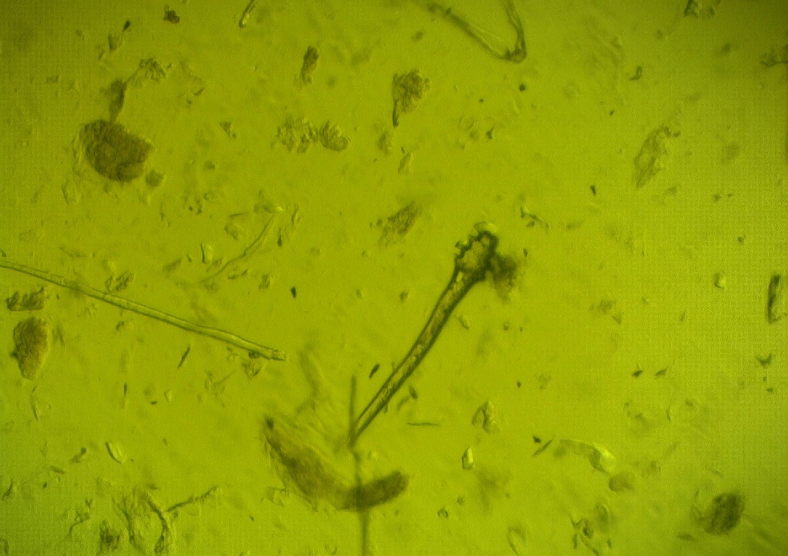 demodex nymphe