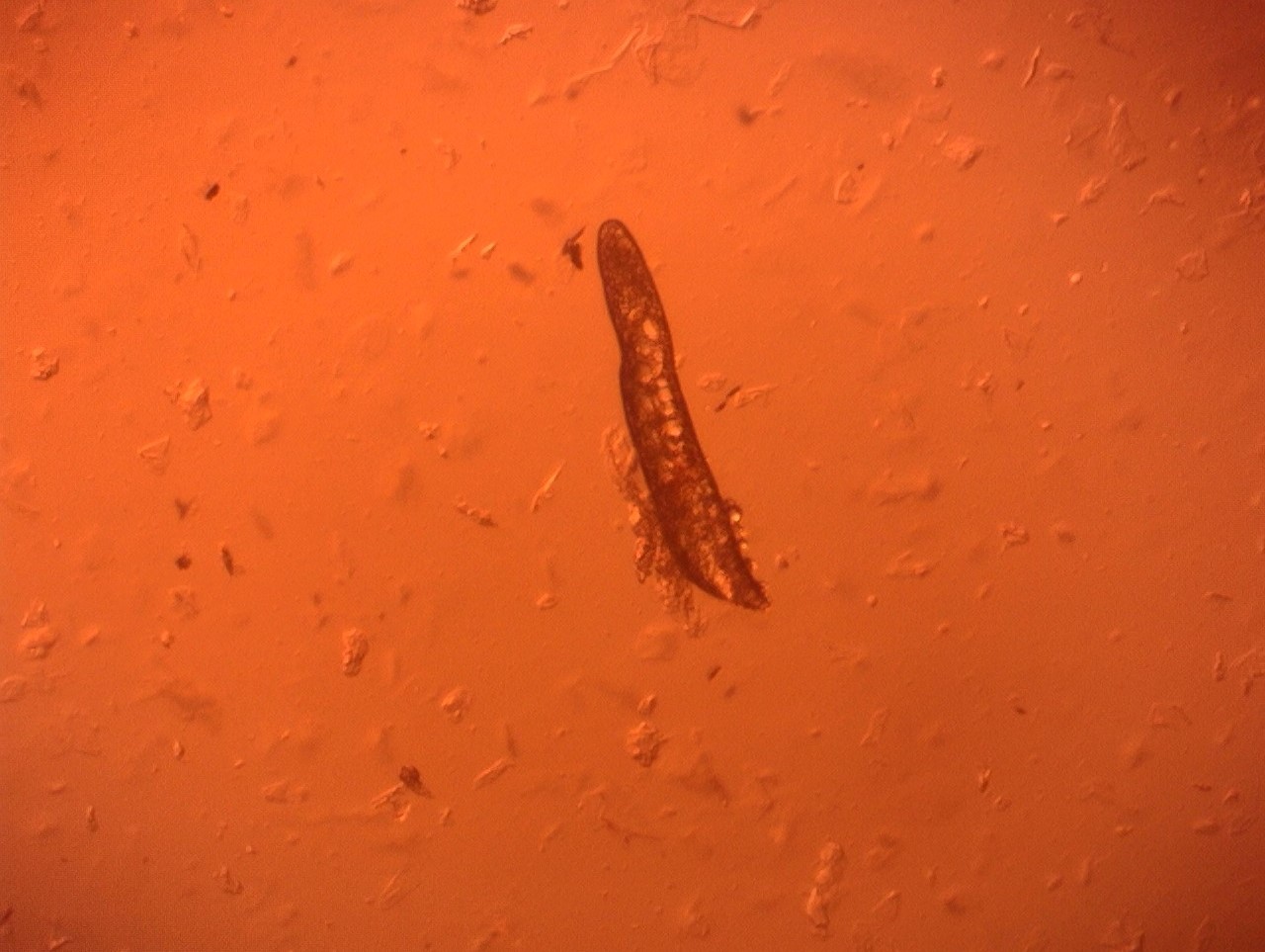 demodex folliculorum