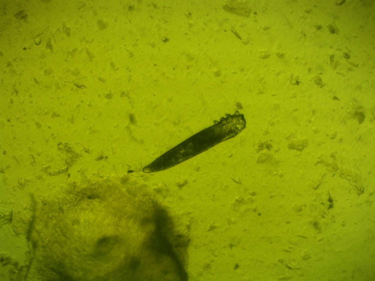 demodex folliculorum
