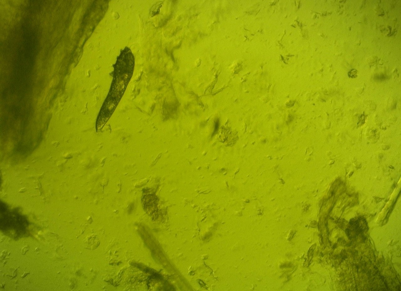 demodex folliculorum
