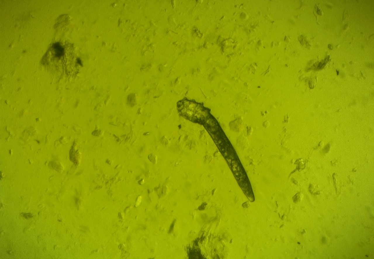 demodex folliculorum