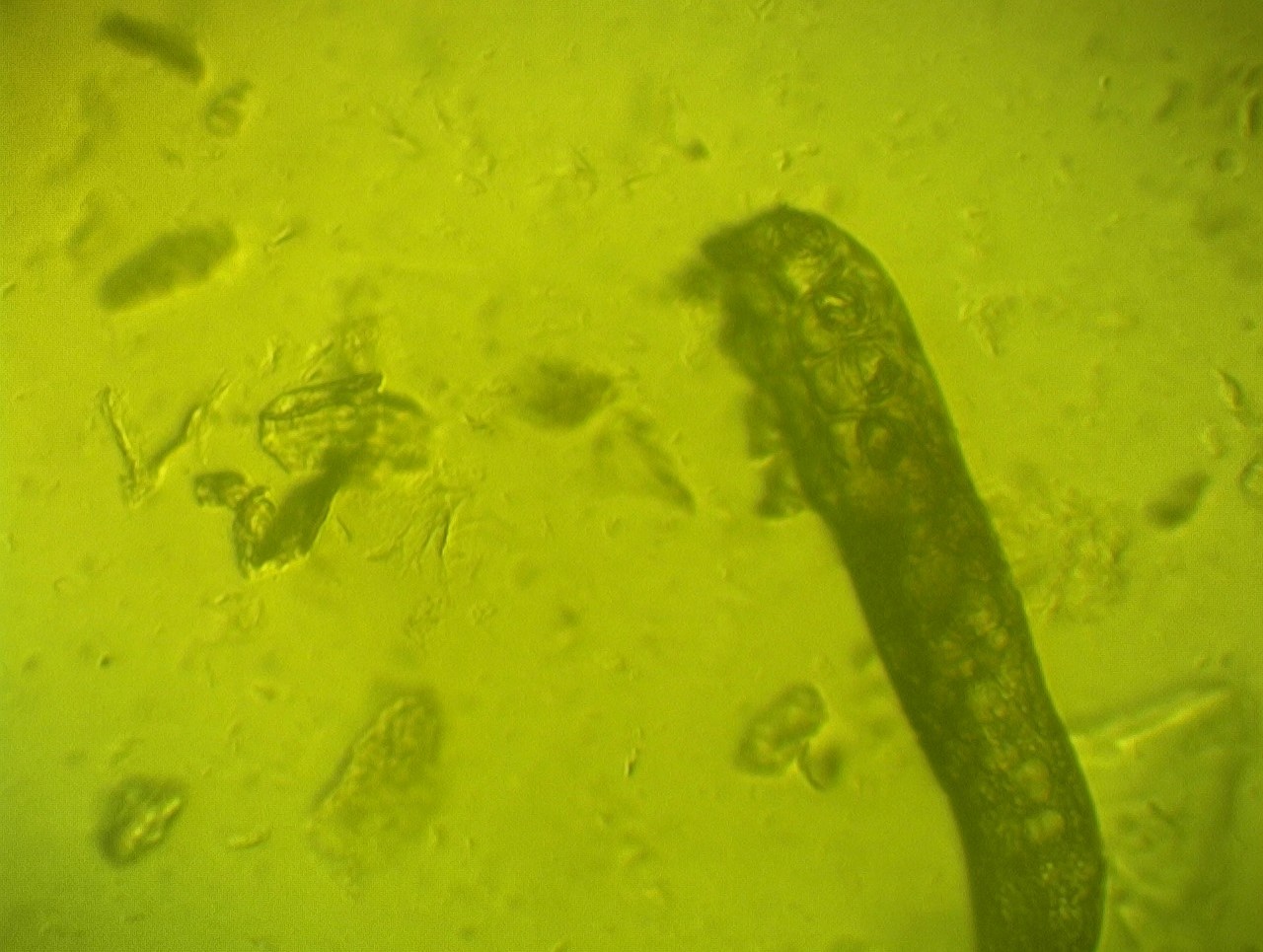 demodex folliculorum