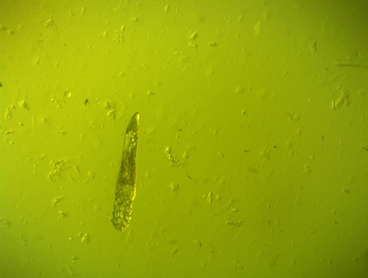 demodex folliculorum